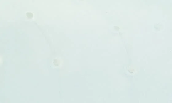 Mostro Jelly Sneaker - Image 7